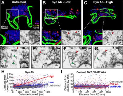 Synuclein Regulates Synaptic Vesicle Clustering and Docking at a Vertebrate Synapse